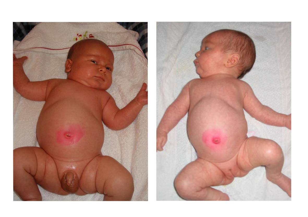 petite comparaison